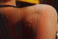 Close-up of sweaty skin with many water droplets on a textured surface, likely on an elbow or knee, with a small heart-shaped sticker visible in the lower-right corner.