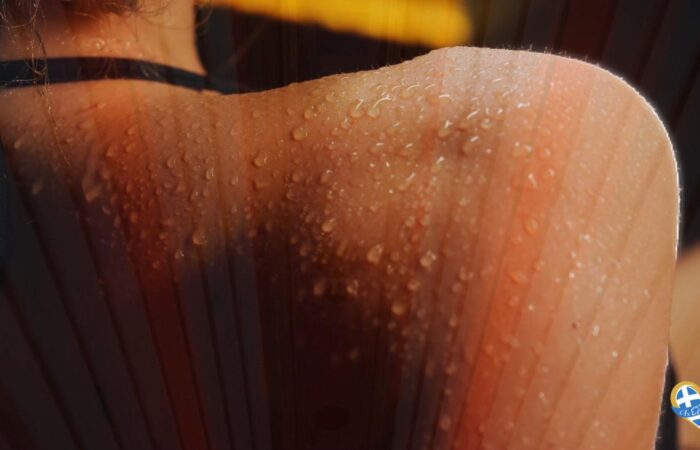 Close-up of sweaty skin with many water droplets on a textured surface, likely on an elbow or knee, with a small heart-shaped sticker visible in the lower-right corner.
